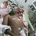 Anak Disabilitas Yatim Piatu Dihakimi Massa Hingga Koma di Karawang