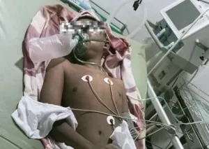 Anak Disabilitas Yatim Piatu Dihakimi Massa Hingga Koma di Karawang