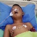 BREAKING NEWS: Anak Disabilitas Diamuk Massa di Cilamaya Wetan Akhirnya Meninggal Dunia